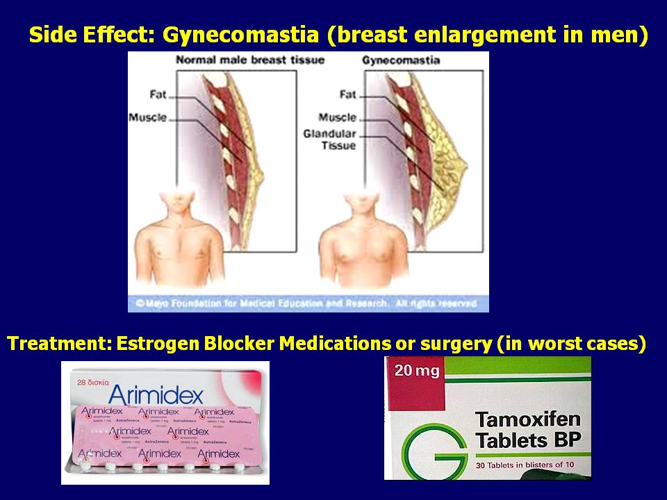 gynecomastia anastrozole arimidex tamoxifen