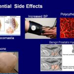 testosterone side effects