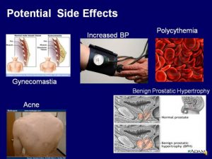 testosterone side effects